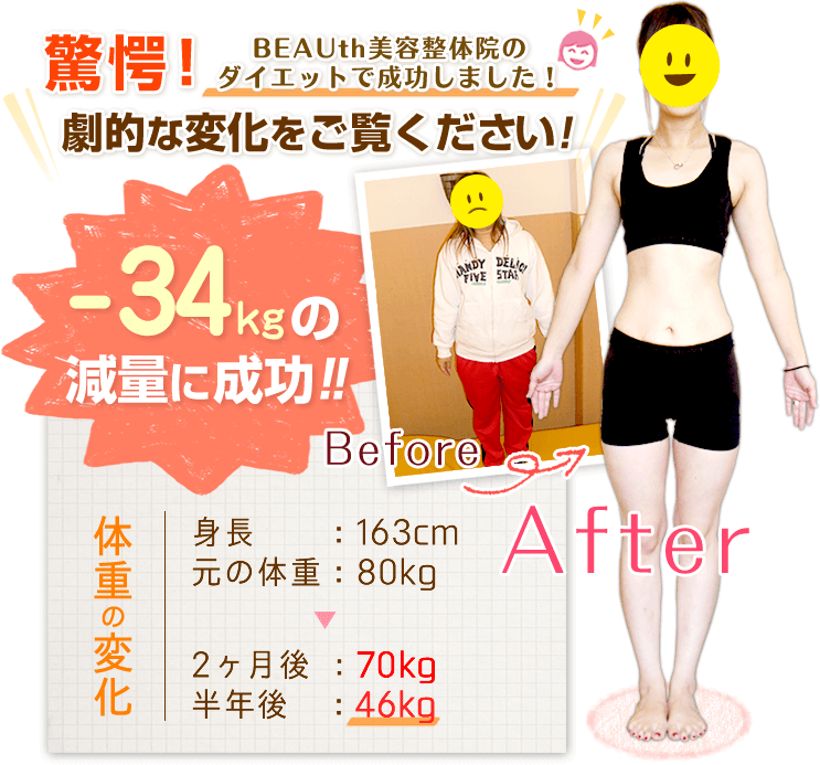 生駒市 Beauth美容整体院 ダイエット 産後の骨盤矯正